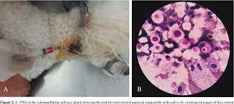 Image result for Sialoadenitis