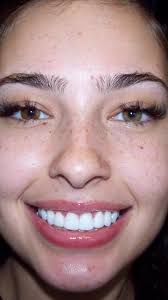 Xash Xash Before and After