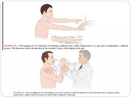 Image result for Cerebellar Function Test