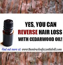The control group used only carrier oils for their massage, also daily. Cedarwood Essential Oil For Hair Loss How It Works Usage Tips The Miracle Of Essential Oils