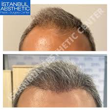 Istanbul aesthetics and medical surgery center is a plastic surgery hospital established to render good services for you with high technology devices and . Istanbul Aesthetic Center Posts Facebook