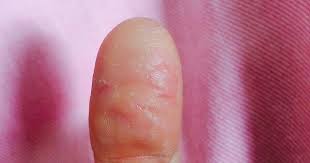 Image result for Cardboard Allergy