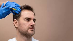 Why Choose a Hair Transplant in Turkey? Discover Top Reasons