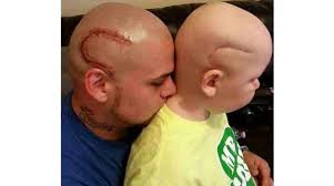 Veja mais ideias sobre dia do pai ideias, camiseta dia dos pais, pai e filho. Pai Faz Tatuagem Igual A Cicatriz Do Filho Que Luta Contra O Cancer Bebe Mamae