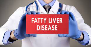 Fatty Liver Disease Affects About 25 Of People Globally Here Is A Detailed Look At Fatty Liver As Well As Some Fatty Liver Disease Liver Disease Fatty Liver