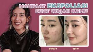 Begini Cara Eksfoliasi Yang Tepat Agar Tidak Merusak Kulit Wajah Youtube