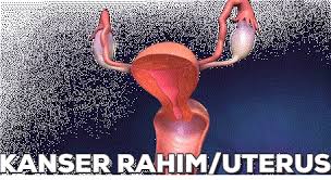 Berminat nak belajar tentang saham patuh syariah klik sini ==>> saham. Kanser Rahim Yang Boleh Dirawat