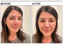 The 9 Best Vitamin C Serums of 2024, Tested and Reviewed