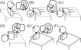 Image result for Canalith Repositioning Procedure