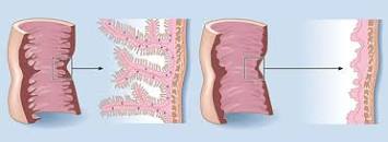 Image result for zöliakie