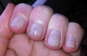 Having a healthy nails after acrylics may be a challenge unless you give them the required treatment and care. Thin Flimsy Nails After Acrylics Google Search Pink Acrylic Nails Nails After Acrylics Nail Repair