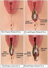 Internal Anal Sphincter Clinical Perspective Sciencedirect
