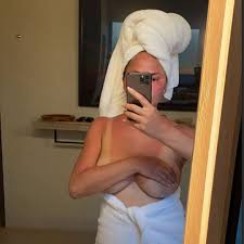 Chrissy Teigen Reveals Brutal Sunburn in Topless Mirror Selfie