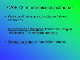 ◦ neoplasias hematológicas, tratamiento con glucocorticoides. Ppt Hallazgos Radiologicos En La Mucormicosis M Larios A Soley D Villa S Rosa C Delgado T Sempere Hospital Univ Powerpoint Presentation Id 964164