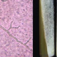 Diferencias de las zigomicosis mucormicosis entomoftoromicosis agente etiologico mucor. Examen Directo Con Hifas Cenociticas Dicotomicas Koh 10x 40x Download Scientific Diagram