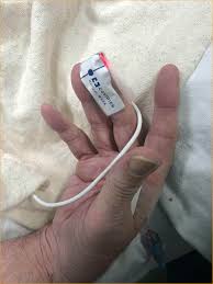 Image result for Tetany