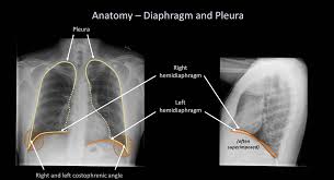 Anatomy of chest x ray. Chest X Ray For Students How To Interpret And Present Methodically Andreas Astier