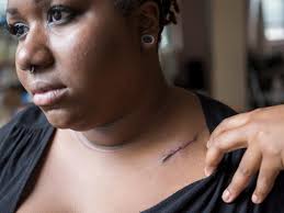 Profile for Lyssette's Cancer blog