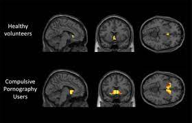 Porn effects on brain