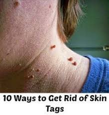 Pin On Combination Skin Skincare
