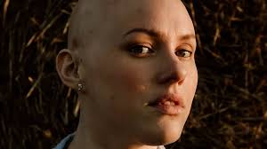 Model covered hair loss for 16 years from age 13 with wigs