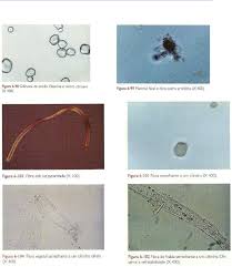 Grátis: URINÁLISE - EXAME MICROSCÓPICO - Material Claro e Objetivo em PDF  para Estudo Rápido