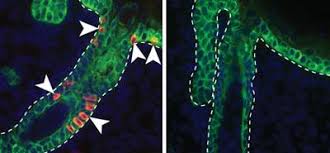 Merkel cells are found mainly at the base of the top layer of the skin (the epidermis). New Study Resolves The Mysterious Origin Of Merkel Cells