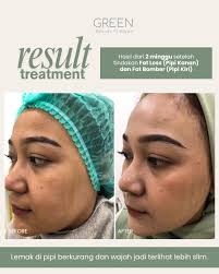 Escape into Calm: Experience Luxury Facial Therapy for Self-Care