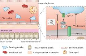 Maybe you would like to learn more about one of these? The Role Of Platelets In Acute Kidney Injury Nature Reviews Nephrology