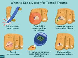 When To Seek Treatment For Toenail Trauma