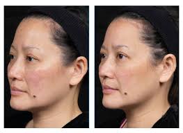 Treiber Dermatology Associates