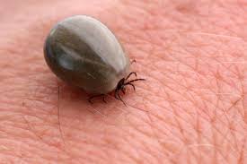 L'érythème migrant (em) est le signe le plus constant et le plus caractéristique de la maladie de lyme, borréliose transmise par morsure de tique. Ca N A Pas De Science La Maladie De Lyme Planete Sante