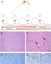 Bei itraq (isobaric tags for relative and absolute quantitation) handelt es sich um eine experimentelle methode aus dem bereich der proteinanalytik und proteomik. Itraq Based Proteomics Profiling Reveals Increased Metabolic Activity And Cellular Cross Talk In Angiogenic Compared With Invasive Glioblastoma Phenotype Molecular Cellular Proteomics
