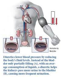 Image result for Diuretic