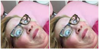 Since the skin around the pubic area is sensitive, and the hair is thick and coarse, you have to be extra cautious when removing pubic hair to prevent skin irritation. What Is Sugaring I Tried Sugaring To Remove Pubic Hair Video Review Yourtango