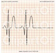 Clipart Of A Heart Beat Ekg Chart Royalty Free Vector
