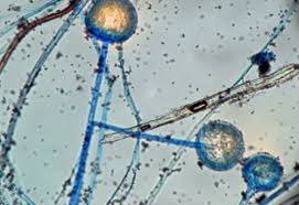 Matosa es muy poco frecuente y , a menudo, es fatal producida por bacterias formadoras de gas. Tema 28 Infecciones Micoticas Tarjetas De Memoria Quizlet