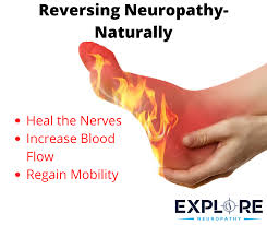 There is substantial evidence that osteoarthritis can be reversible. Explore Neuropathy Home Facebook