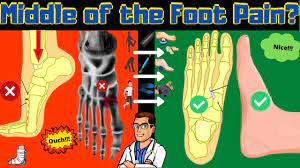 Cuboid Syndrome Self Treatment Cuboid Bone Outside Of Foot Pain Youtube