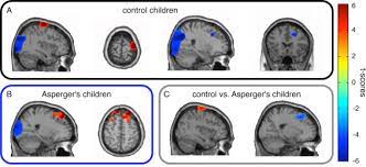 Helping different kinds of minds succeed. Meg Premotor Abnormalities In Children With Asperger S Syndrome Determinants Of Social Behavior Sciencedirect