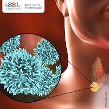 Most growths don't cause any symptoms. Thyroid Cancer Problems Types Symptoms Causes