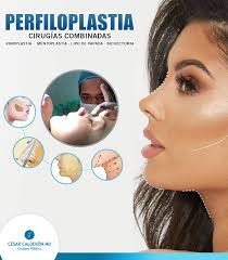 La #Perfiloplastia refiere a un conjunto de técnicas quirúrgicas que tiene  como objetivo realzar la belleza y armonía del rostro. Los procedimientos  que conforman estas técnicas son: ✔️#Rinoplastia (corrige las  imperfecciones de
