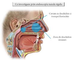 We did not find results for: Endoscopia Nazala Rigida Medic Chirurg Orl Dr Razvan Filip