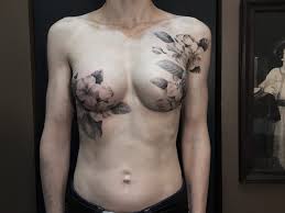 Some women choose to go flat, some get breast prosthesis, others get implants, some have traditional breast reconstruction surgery, and some undergo areola tattooing. Reclaiming Their Beauty Tattoo Artist Inks Exquisite Flowers Over Mastectomy Scars Commonhealth