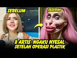 Penyebab Ibu Raffi Ahmad Dioperasi, Usus Mama Amy Bermasalah