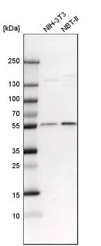 Скит скит намбер ван чит. Anti Crbn Antibody Produced In Rabbit Prestige Antibodies Powered By Atlas Antibodies Affinity Isolated Antibody Buffered Aqueous Glycerol Solution Sigma Aldrich
