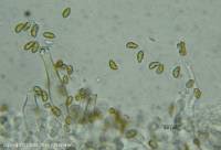 Image result for Inocybe hystrix