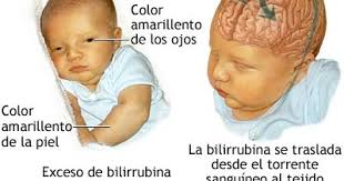 Virus ini berupa sebuah virus rna sebesar 40 hingga 50 nm dengan indra positif dari keluarga flaviviridae. Jihajumi Petua Jaundis Demam Kuning