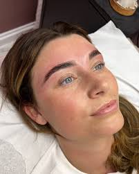 Kirsten at Dermalounge