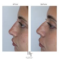 Dr Haim Tal l קליניקה לאסתטיקה רפואית‎ (@dr.haim_tal) • Instagram photos  and videos